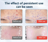 7＋1 Colors LED  Face Mask and Neck  with 850NM Near-infrared Rechargeable Red Light Therapy Mask Skin Care Device for Anti-Aging